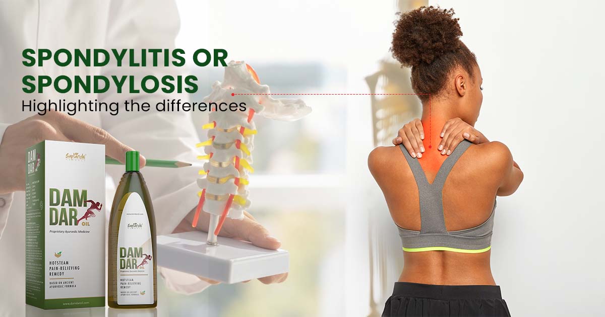 Spondylitis Versus Spondylosis: Highlighting the Differences